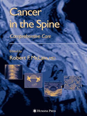 cover image of Cancer in the Spine